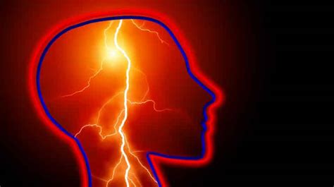 Epilepsie Eine Fehlfunktion Des Gehirns Gesundheits Fragede