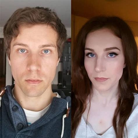Before And After Hormone Therapy