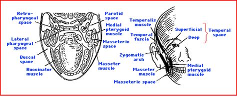 Infections Of The Oral Cavity Neck And Head