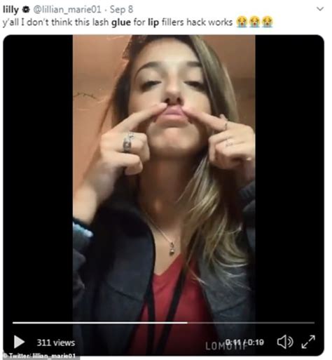 Latest Social Media Craze Has Women Gluing Lips Up Toward Nose For