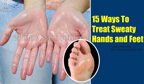 15 Ways To Treat Sweaty Hands And Feet
