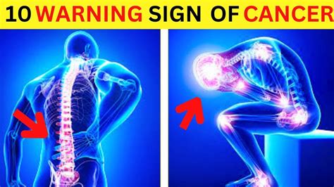 10 Warning Signs Of Cancer You Shouldnt Ignore Youtube