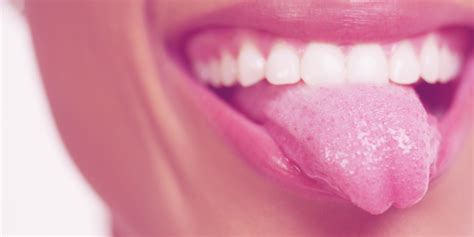 What Your Tongue Can Tell You About Your Health Stavya Dental Clinic