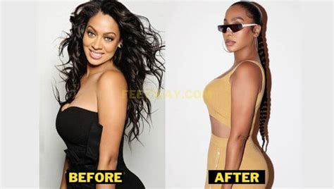 Lala Anthony Plastic Surgery Details With Before And After Pictures