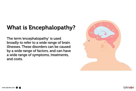 Encephalopathy Treatment Procedure Cost Recovery Side Effects And More