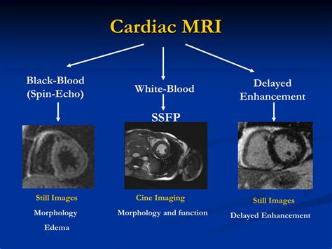 Ppt The Use Of Cardiac Ct And Mri In Clinical Practice Powerpoint