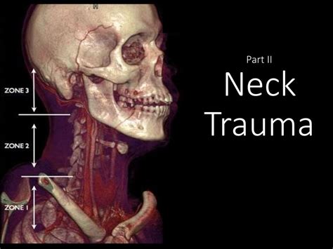 Neck And Facial Trauma