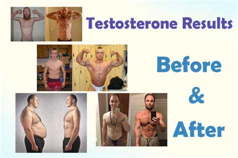 Treatment Of Low Testosterone Before And After Hrtus