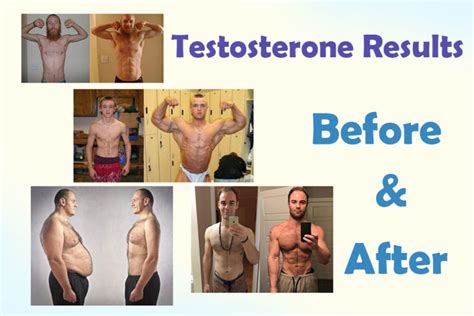 treatment of low testosterone before and after hrtus