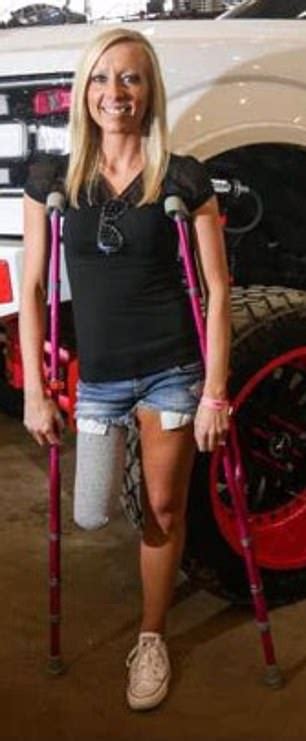 Amputee Mother Competes In Tough Mudder Races On Crutches And Is Now A