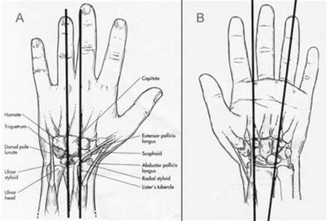 Wrist Dorsal Compartment Anatomy