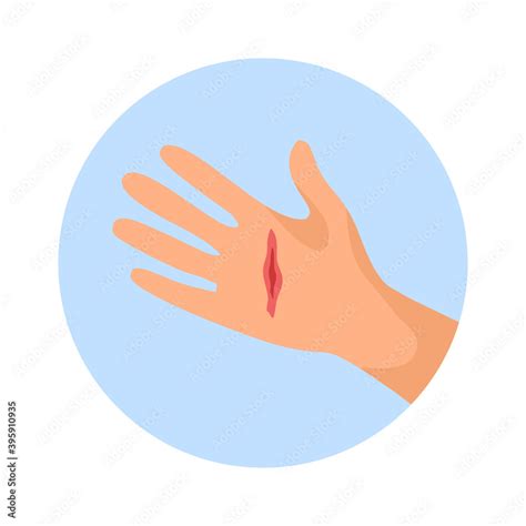 Cut Injury With Red Blood On Palm In Flat Design Wound On Hand Concept