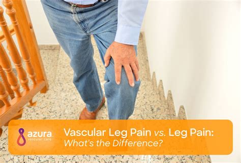 Vascular Leg Pain Vs Leg Pain Whats The Difference