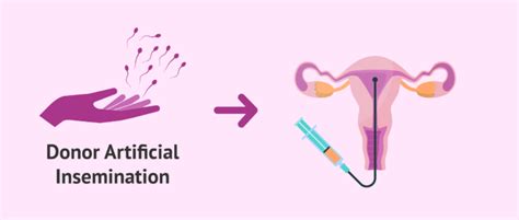artificial insemination with donor sperm