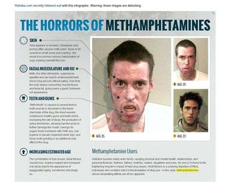 faces of meth photos faces of meth ny daily news