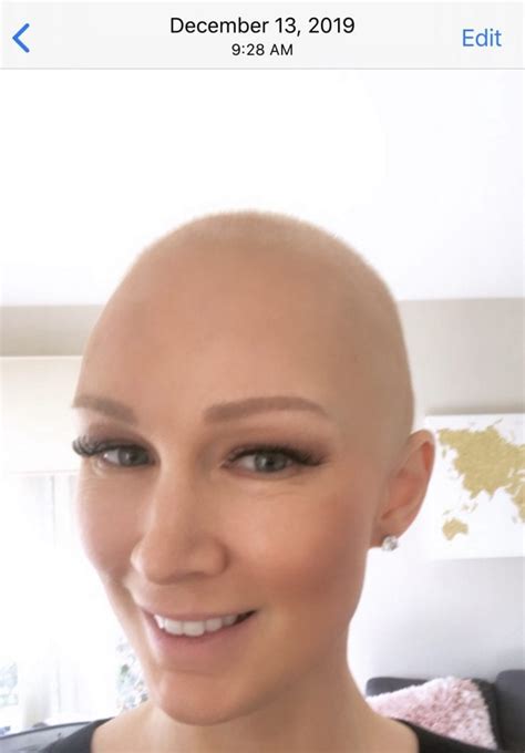 Hair Growth After Chemo Timeline With Pictures Kamelia Britton