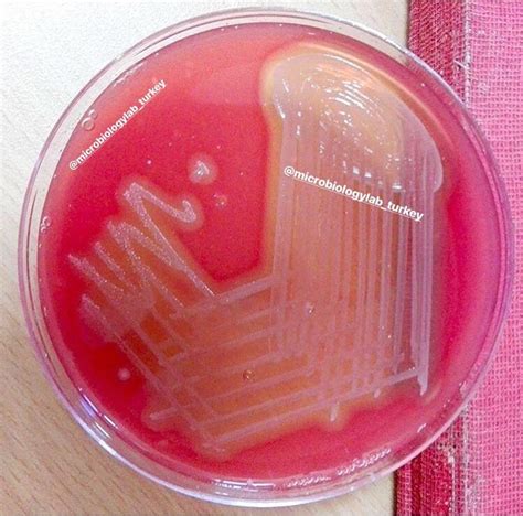 Staphylococcus Spp English Microbiology Laboratory Turkey