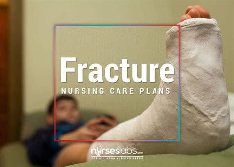 Fracture Nursing Care Plan Realtec