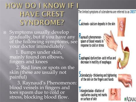 What Is Crest Disease Crest Syndrome Medlineplus Medical Encyclopedia
