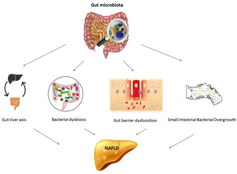 Contribution Of Gut Microbiota To Nonalcoholic Fatty Liver Disease