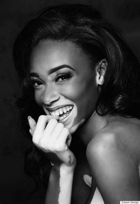 Model Winnie Harlow Talking Beyond Colour Yes Im A Strong Black