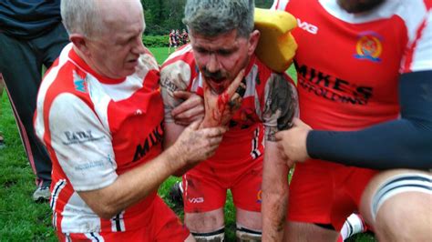 Horror Pictures After Alleged Pitch Attack That Left Rugby Player With
