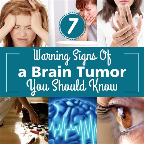 7 Warning Signs Of A Brain Tumor You Should Know With Images Brain