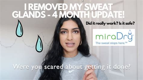 I Removed My Sweat Glands Part 2 4 Month Miradry Update Does It