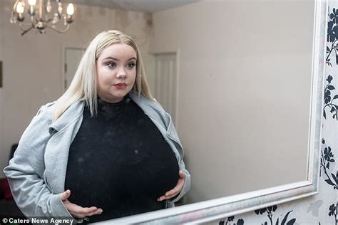 Meet 25 Year Old Lady With Massive B00bs That Wont Stop Growing Due To