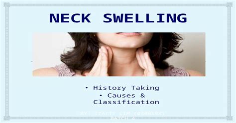 Neck Swelling History Taking Causes Classification Pptx Powerpoint