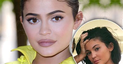 who s that kylie jenner gets rid of lip fillers