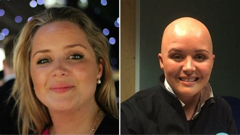 Bbc News Shaving Head Gave Me Control Says Ni Alopecia Sufferer