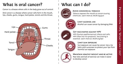 Causes Of Oral Cancer