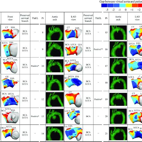 Aortic Arch Morphology And Gap Distribution Mapping For All Cases Bca