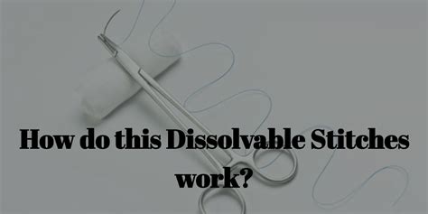 How Do Dissolvable Stitches Work