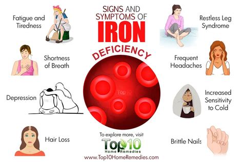 The signs and symptoms of an iron deficiency depend on whether the patient is anaemic, and if so, how fast the anaemia develops. 10 Signs and Symptoms of Iron Deficiency | Top 10 Home ...