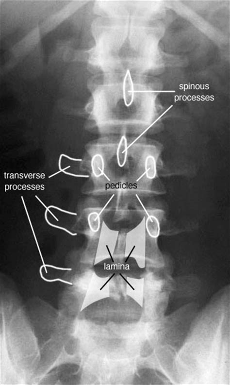 coluna vertebral cto