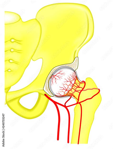 Vector Illustration Anatomy Of A Healthy Human Hip Joint And A Vascular