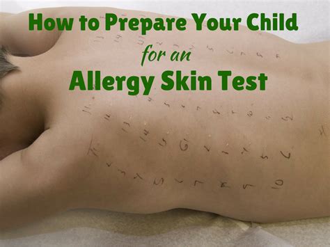 Learn to spot the signs and get the information you need to feel better for good. How to Prepare Your Child for an Allergy Skin Test