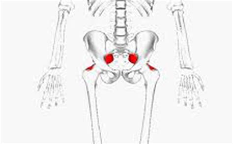 Piriformis Syndrome Feature Activaided