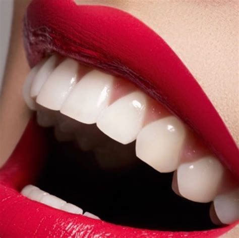 Get The Most Amazing Confident And Perfect Smile With This Secret