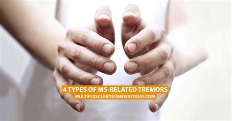 Types Of MS Related Tremors Multiple Sclerosis News Today