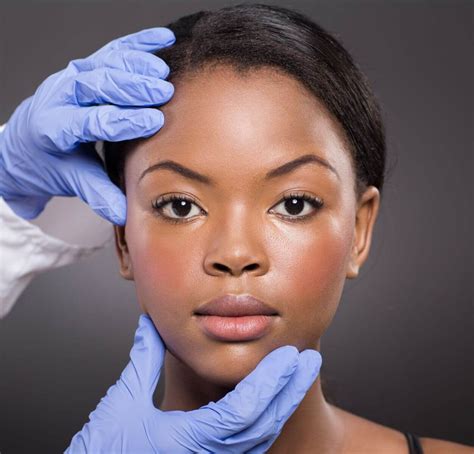 Rosacea May Be Underdiagnosed In Skin Of Color