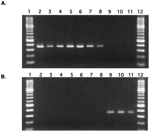 Differentiation Of Members Of The M Tuberculosis Complex By Using Pcr