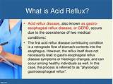 Acid Reflux Symptoms Mayo Clinic