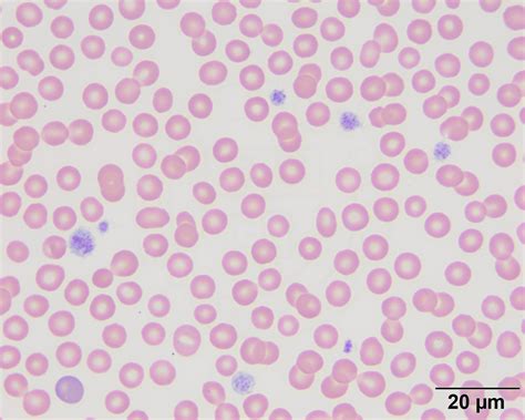 Inherited Macrothrombocytopenia In A Cavalier King Charles Spaniel
