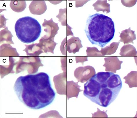 Reactive And Atypical Lymphocyte Morphologies Complete Hematological