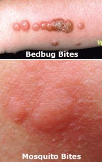 If you've noticed a group of small, itchy, red dots on your skin, it could really be a whole host of things. Bug GO!: Mosquito Bite vs Bed Bug Bite