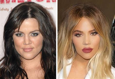 Celebrities Before Plastic Surgery 10 Pics