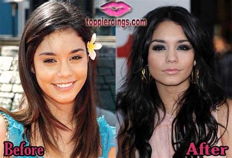Vanessa Hudgens Nose Job Before And After Photos Top Piercings